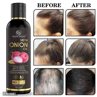 Ocean Onion Methi Oil For Hair Fall Control, Hair Growth and Hair Regrowth-Control Dandruff - Pack Of 1-thumb0