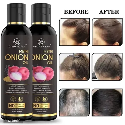 Ocean Onion Methi Oil For Hair Fall Control, Hair Growth and Hair Regrowth-Control Dandruff - Pack Of 2