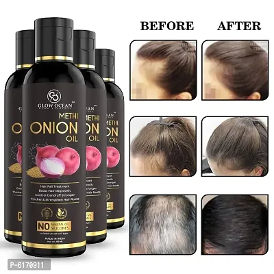 Ocean Onion Methi Oil For Hair Fall Control, Hair Growth and Hair Regrowth-Control Dandruff - Pack Of 4
