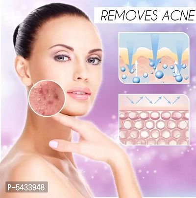 Ewy Make Up Face Salicylic Acid Ice Mask Pack Of 2 Skin Care Face-thumb3