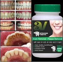 Teeth Whitening Powder With Best Result-thumb1