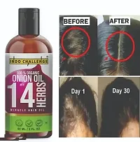 INDO CHALLENGE  Onion Hair Oil with 14 Essential Oils, Onion Hair Oil For Hair Growth For Specially Men and Women-thumb2