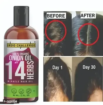 INDO CHALLENGE  Onion Hair Oil with 14 Essential Oils, Onion Hair Oil For Hair Growth For Specially Men and Women-thumb3