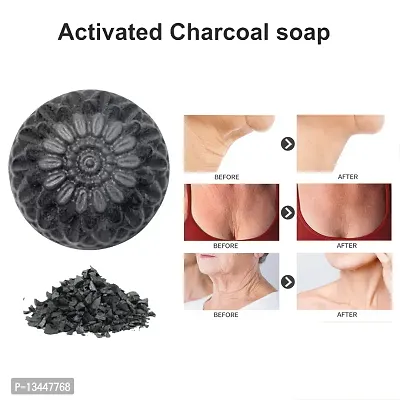 Activated Charcoal Soap For Women Skin Whitening, Blackheads, Face And Body Soap-thumb0