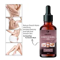 Body stretch mark removal Oil (pack of 1) 40 ml)  40 ml)-thumb2