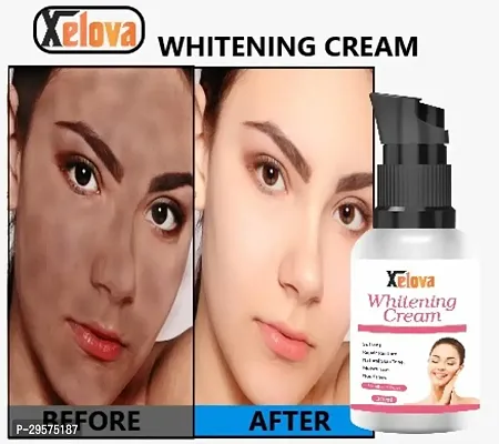 Skin Whitening Cream For Face- 30 ml-thumb0