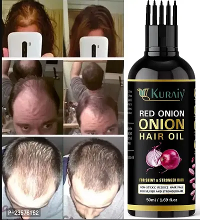 KURAIY Onion Hair Oil for Hair Growth  Hair Fall Control with Redensyl  Hair Oil.