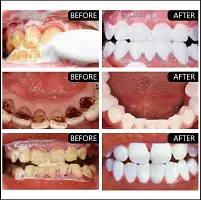 KURAIY Whitening Tooth Powder 100g, Remove Smoke Stains, Coffee , Tea , Freshen Dad Breath, Oral Hygiene, Dental Care PACK OF 2-thumb2