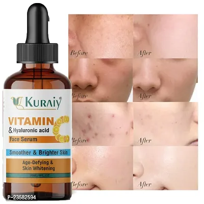 Kuraiy Vitamin C Face Serum - Skin Brightening Serum , Anti-Aging, Skin Repair, Supercharged Face Serum, Dark Circle, Fine Line  Sun Damage Corrector Face Serum -30 ml