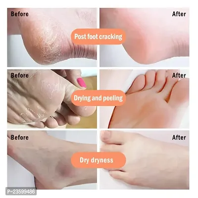 KURAIY Foot Crack Cream For Dry Cracked Heels  Feet Foot Cream (50gm) Pack of 1-thumb2