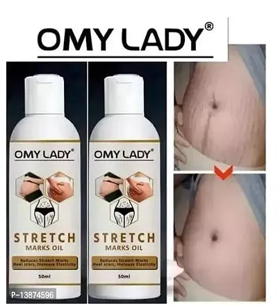 OMY LADY Present Repair Stretch Marks Removal Natural Heal Pregnancy Breast, Hip, Legs, Mark Oil ( PACK OF 2)