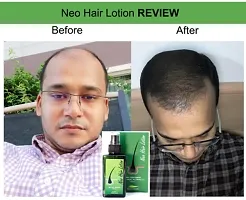 NEO HAIR LOTION 120ML PACK OF 1 FOR MAN\WOMEN-thumb1