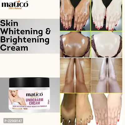 Matico Underarm Whitening cream, Neck Whitener, Body Brightening, Moisturizer