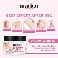 Matico Underarm Whitening cream, Neck Whitener, Body Brightening, Moisturizer-thumb1