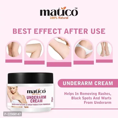 Matico Underarm Whitening cream, Neck Whitener, Body Brightening, Moisturizer-thumb2