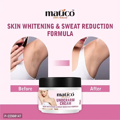 Matico Underarm Whitening cream, Neck Whitener, Body Brightening, Moisturizer-thumb3