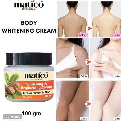 Matico Whitening Cream for skin Brightening, Fairness cream, Glow cream (100gm)