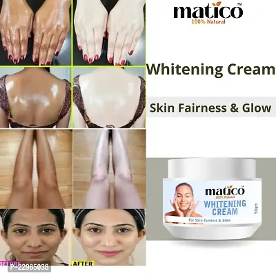 Matico Skin Fairness Cream for whitening and brightening, acne oil control. - 50gm
