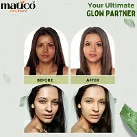 Matico Skin Fairness Cream for whitening and brightening, acne oil control. - 50gm-thumb2