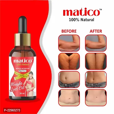 Matico Ayurvedic Weight loss oil, slimming oil, Fat burner for body-thumb2