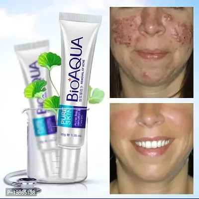 Bioaqua Acne Rejuvenation Cream For Scars, Acne, Pores (Combination) 30g-thumb0