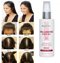 Trendy Onion Oil For Hair Regrowth And Hair Fall Control Hair Oil Pack Of 3-thumb1