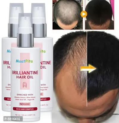 Trendy Onion Hair Oil Hair Regrowth Oil Controls Hair Fall And Dandruff For Men And Women Pack Of 3-thumb0