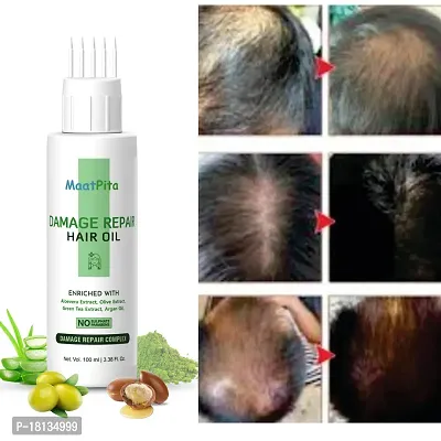 Adivasi Hair Oil All Type Of Hair Problem Herbal Growth Hair Oil 100 Ml Pack 1-thumb2