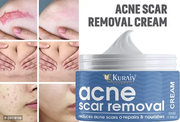 KURAIY Natural Herbal Acne Removal Face Cream Anti-Acne Gel Treatment Acne Scar Oil Control Eliminate Pimples Whitening Moisturizing Care
