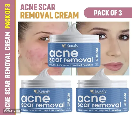 KURAIY Acne Cream Remove Acnes Pimples Whiten Dark Spot Scars Anti Acne Treatment Gel Shrink Pack of 3