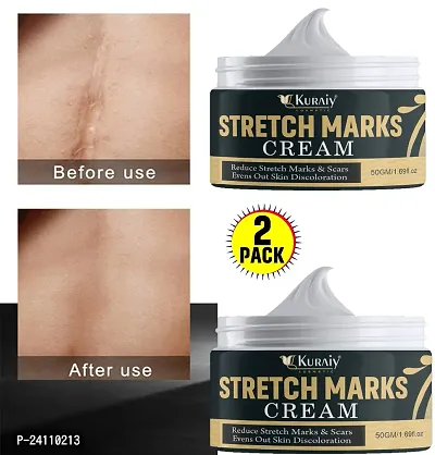 KURAIY Scar Repair Cream Acne Scars Remove Pregnant Women Skin Care Stretch Marks Removal Maternity Fat (PACK OF 2)