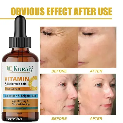 Kuraiy Vitamin C Face Serum - Skin Brightening Serum , Anti-Aging, Skin Repair, Supercharged Face Serum, Dark Circle Face Serum-thumb0