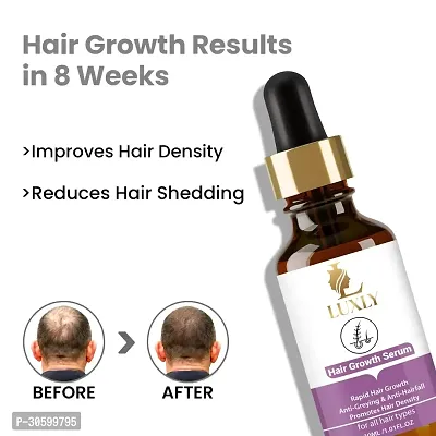 Luxly Hair Growth Serum - 30ml-thumb2