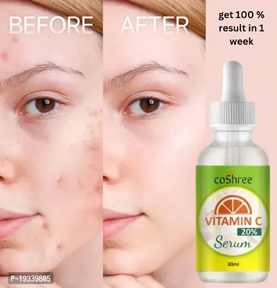 Garnitta Skin Naturals, Face Serum, For Brighter  Clear Skin, Bright Complete Vitamin C Booster, 30 ml