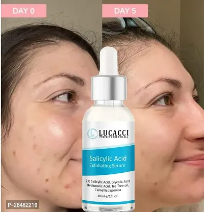 LUCACCI Brightening  Whitening Vitamin C Face Serum, hyaluronic acid for Anti pimple, Acne Free Skin, Aloe Vera extract for face Anti Ageing, Face Oil  Serum for Dry Skin and Oily Skin, Fairness  Face Glow | 30ml *1-thumb0