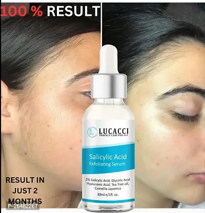 LUCACCI Brightening  Whitening Vitamin C Face Serum, hyaluronic acid for Anti pimple, Acne Free Skin, Aloe Vera extract for face Anti Ageing, Face Oil  Serum for Dry Skin and Oily Skin, Fairness  Face Glow | 30ml *1-thumb0