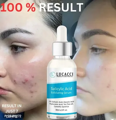 LUCACCI Brightening  Whitening Vitamin C Face Serum, hyaluronic acid for Anti pimple, Acne Free Skin, Aloe Vera extract for face Anti Ageing, Face Oil  Serum for Dry Skin and Oily Skin, Fairness  Face Glow | 30ml *1