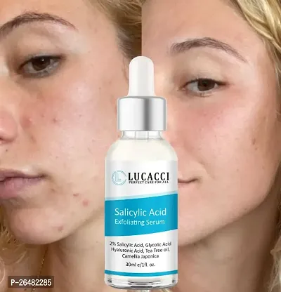 LUCACCI Brightening  Whitening Vitamin C Face Serum, hyaluronic acid for Anti pimple, Acne Free Skin, Aloe Vera extract for face Anti Ageing, Face Oil  Serum for Dry Skin and Oily Skin, Fairness  Face Glow | 30ml *1-thumb0