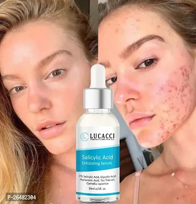 LUCACCI Brightening  Whitening Vitamin C Face Serum, hyaluronic acid for Anti pimple, Acne Free Skin, Aloe Vera extract for face Anti Ageing, Face Oil  Serum for Dry Skin and Oily Skin, Fairness  Face Glow | 30ml *1