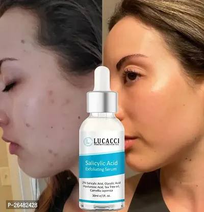 LUCACCI Brightening  Whitening Vitamin C Face Serum, hyaluronic acid for Anti pimple, Acne Free Skin, Aloe Vera extract for face Anti Ageing, Face Oil  Serum for Dry Skin and Oily Skin, Fairness  Face Glow | 30ml *1