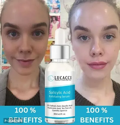 LUCACCI Brightening  Whitening Vitamin C Face Serum, hyaluronic acid for Anti pimple, Acne Free Skin, Aloe Vera extract for face Anti Ageing, Face Oil  Serum for Dry Skin and Oily Skin, Fairness  Face Glow | 30ml *1