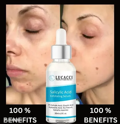 LUCACCI Brightening  Whitening Vitamin C Face Serum, hyaluronic acid for Anti pimple, Acne Free Skin, Aloe Vera extract for face Anti Ageing, Face Oil  Serum for Dry Skin and Oily Skin, Fairness  Face Glow | 30ml *1