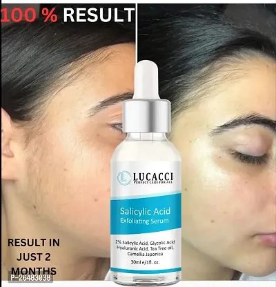 LUCACCI Brightening  Whitening Vitamin C Face Serum, hyaluronic acid for Anti pimple, Acne Free Skin, Aloe Vera extract for face Anti Ageing, Face Oil  Serum for Dry Skin and Oily Skin, Fairness  Face Glow | 30ml *1