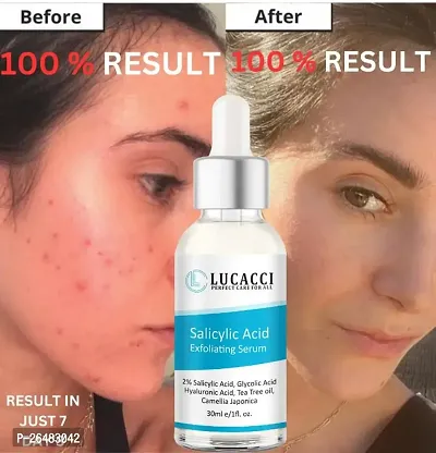 LUCACCI Brightening  Whitening Vitamin C Face Serum, hyaluronic acid for Anti pimple, Acne Free Skin, Aloe Vera extract for face Anti Ageing, Face Oil  Serum for Dry Skin and Oily Skin, Fairness  Face Glow | 30ml *1