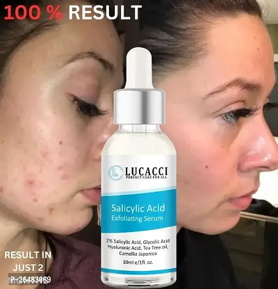 LUCACCI Brightening  Whitening Vitamin C Face Serum, hyaluronic acid for Anti pimple, Acne Free Skin, Aloe Vera extract for face Anti Ageing, Face Oil  Serum for Dry Skin and Oily Skin, Fairness  Face Glow | 30ml *1