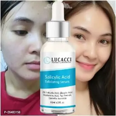 LUCACCI Brightening  Whitening Vitamin C Face Serum, hyaluronic acid for Anti pimple, Acne Free Skin, Aloe Vera extract for face Anti Ageing, Face Oil  Serum for Dry Skin and Oily Skin, Fairness  Face Glow | 30ml *1-thumb0