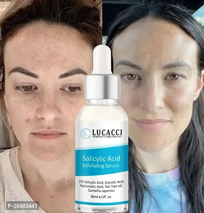 LUCACCI Brightening  Whitening Vitamin C Face Serum, hyaluronic acid for Anti pimple, Acne Free Skin, Aloe Vera extract for face Anti Ageing, Face Oil  Serum for Dry Skin and Oily Skin, Fairness  Face Glow | 30ml *1