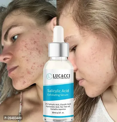 LUCACCI Brightening  Whitening Vitamin C Face Serum, hyaluronic acid for Anti pimple, Acne Free Skin, Aloe Vera extract for face Anti Ageing, Face Oil  Serum for Dry Skin and Oily Skin, Fairness  Face Glow | 30ml *1