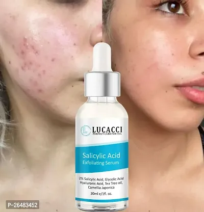 LUCACCI Brightening  Whitening Vitamin C Face Serum, hyaluronic acid for Anti pimple, Acne Free Skin, Aloe Vera extract for face Anti Ageing, Face Oil  Serum for Dry Skin and Oily Skin, Fairness  Face Glow | 30ml *1