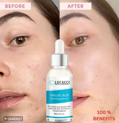 LUCACCI Brightening  Whitening Vitamin C Face Serum, hyaluronic acid for Anti pimple, Acne Free Skin, Aloe Vera extract for face Anti Ageing, Face Oil  Serum for Dry Skin and Oily Skin, Fairness  Face Glow | 30ml *1